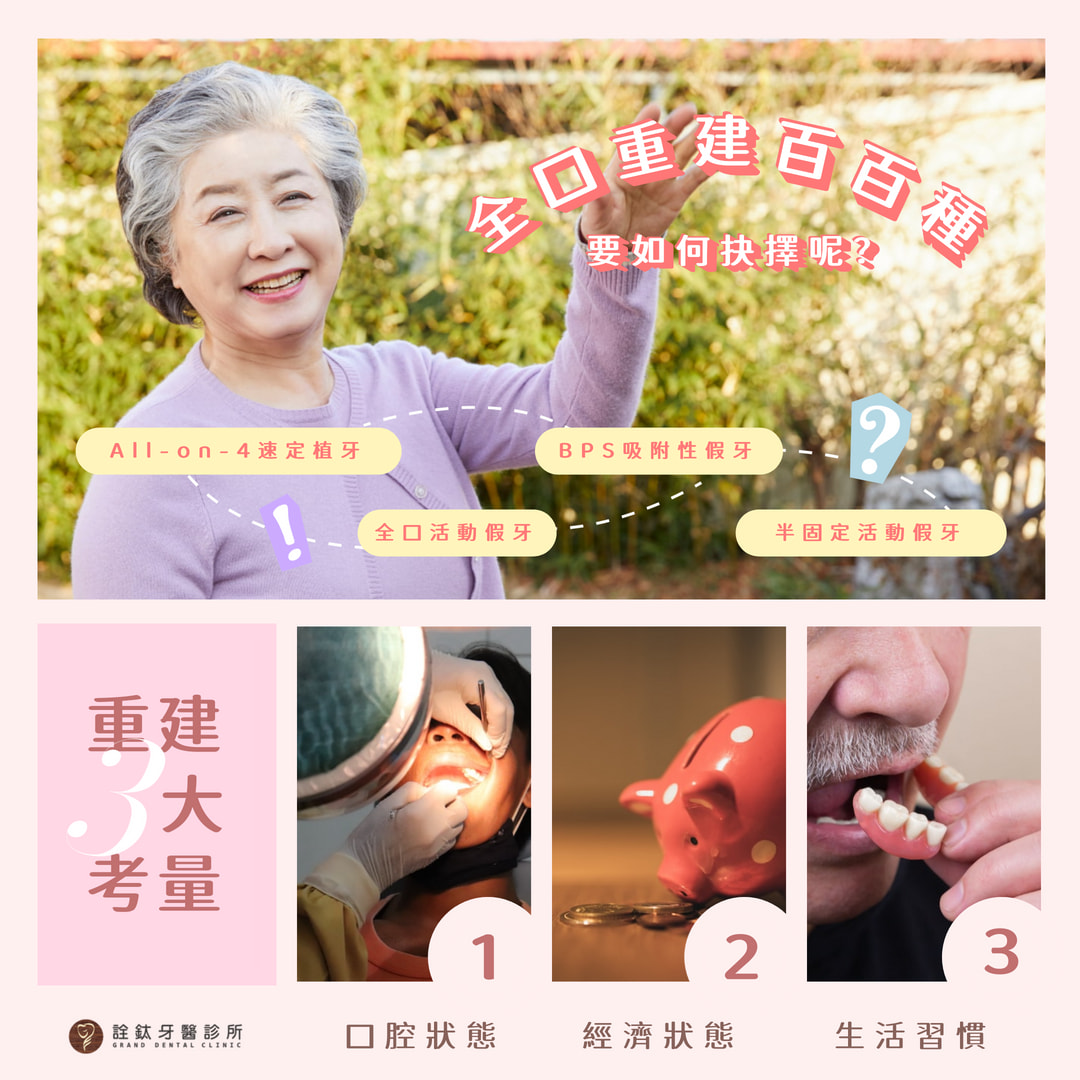 全口重建百百種，如何選擇？