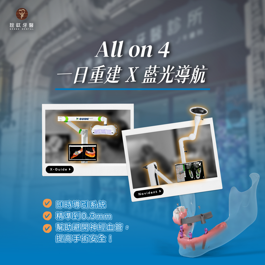 一日重建 X 藍光導航