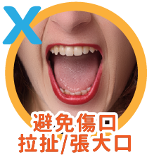 【All-on-4👨🏫術後衛教照護篇】 【All-on-4👨🏫術後衛教照護篇】