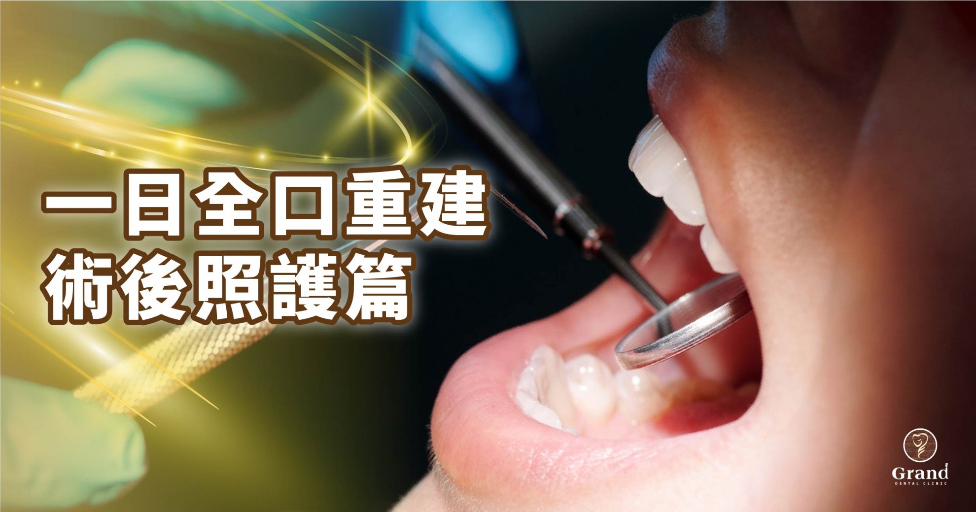 【All-on-4?‍?術後衛教照護篇】