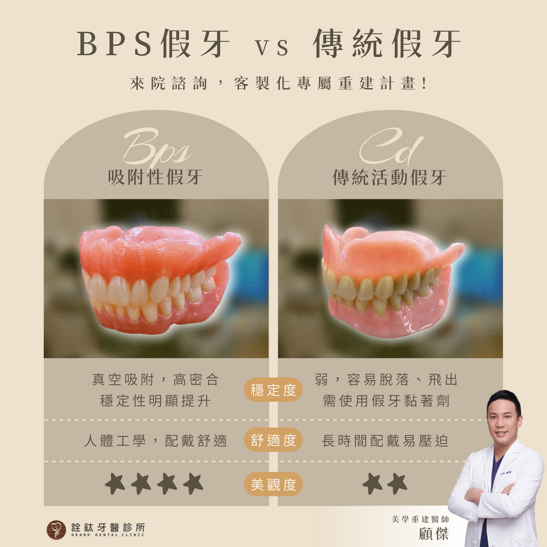 👀【假牙差很大！你選對了嗎？】