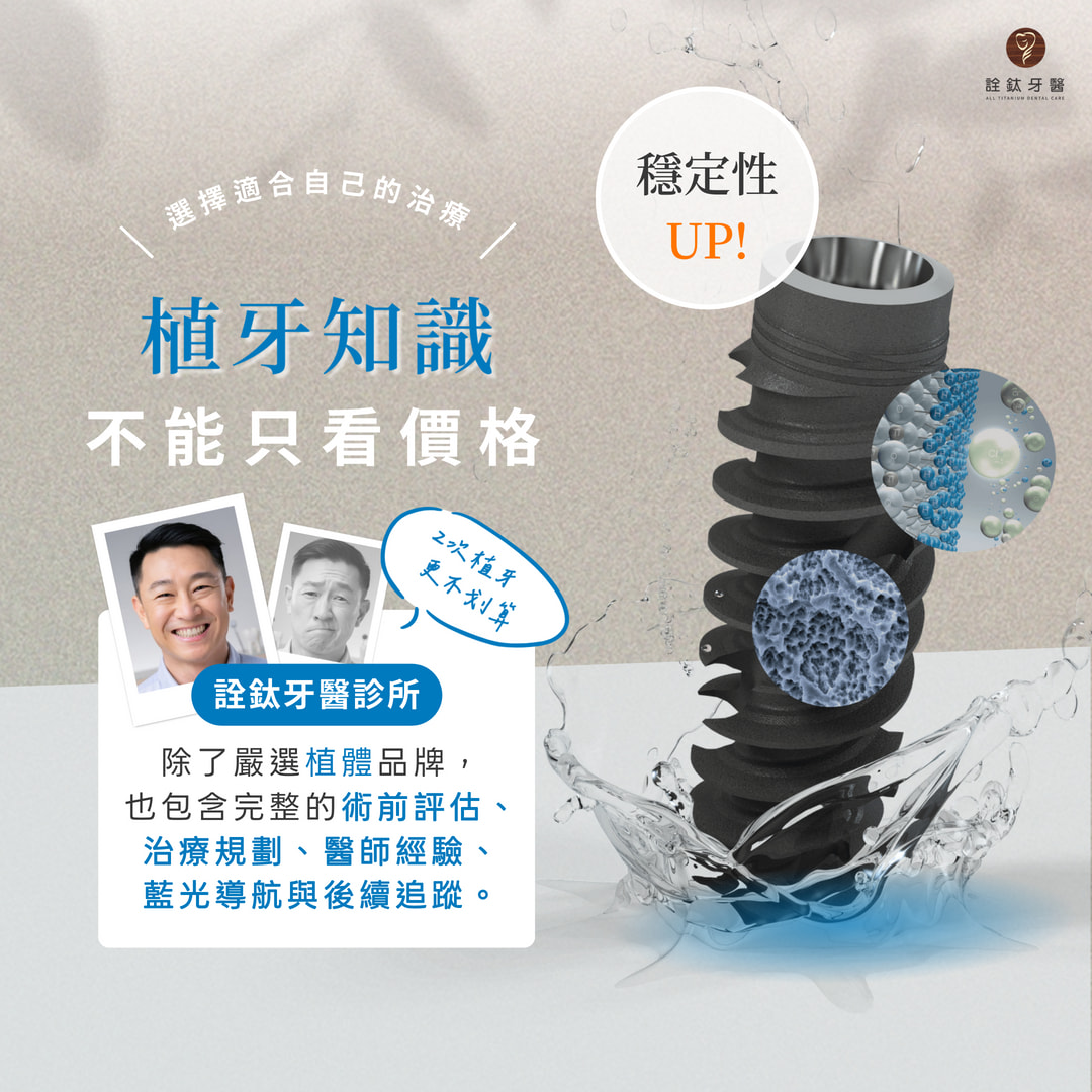 植牙，不能只看價格😬