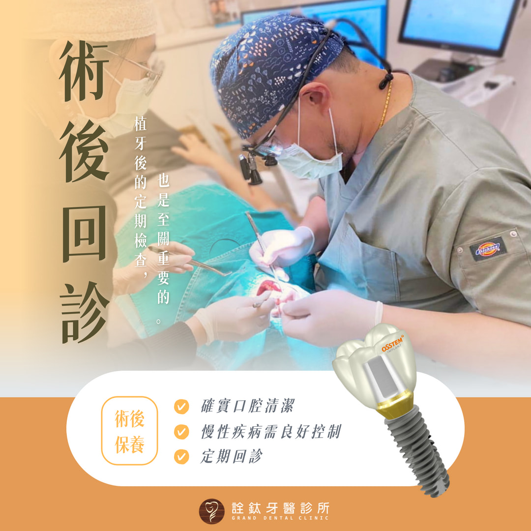 植牙術後回診重要性