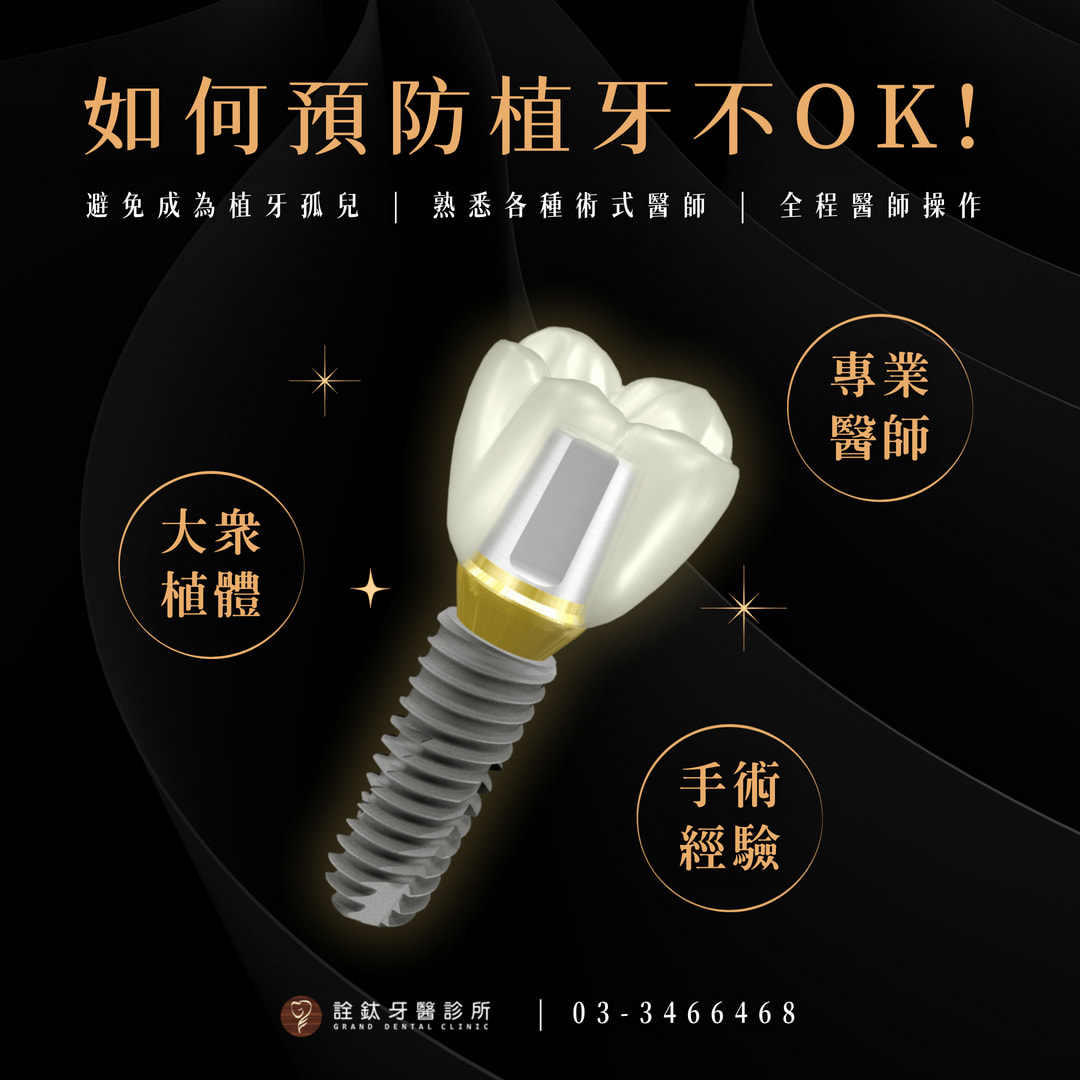 如何預防植牙不OK而失敗，詮鈦有三招!!