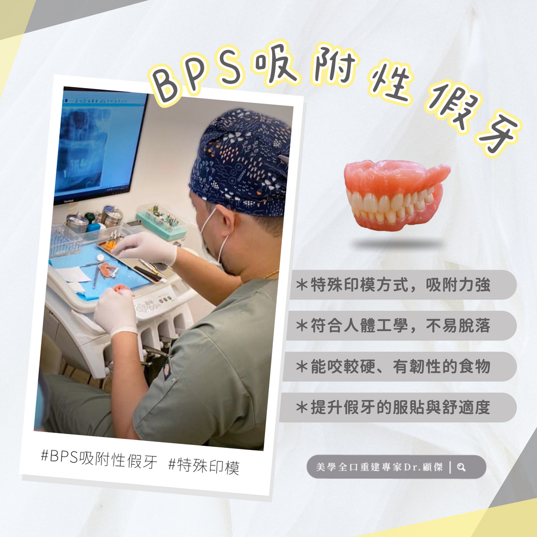 BPS吸附性假牙優勢 ?✨