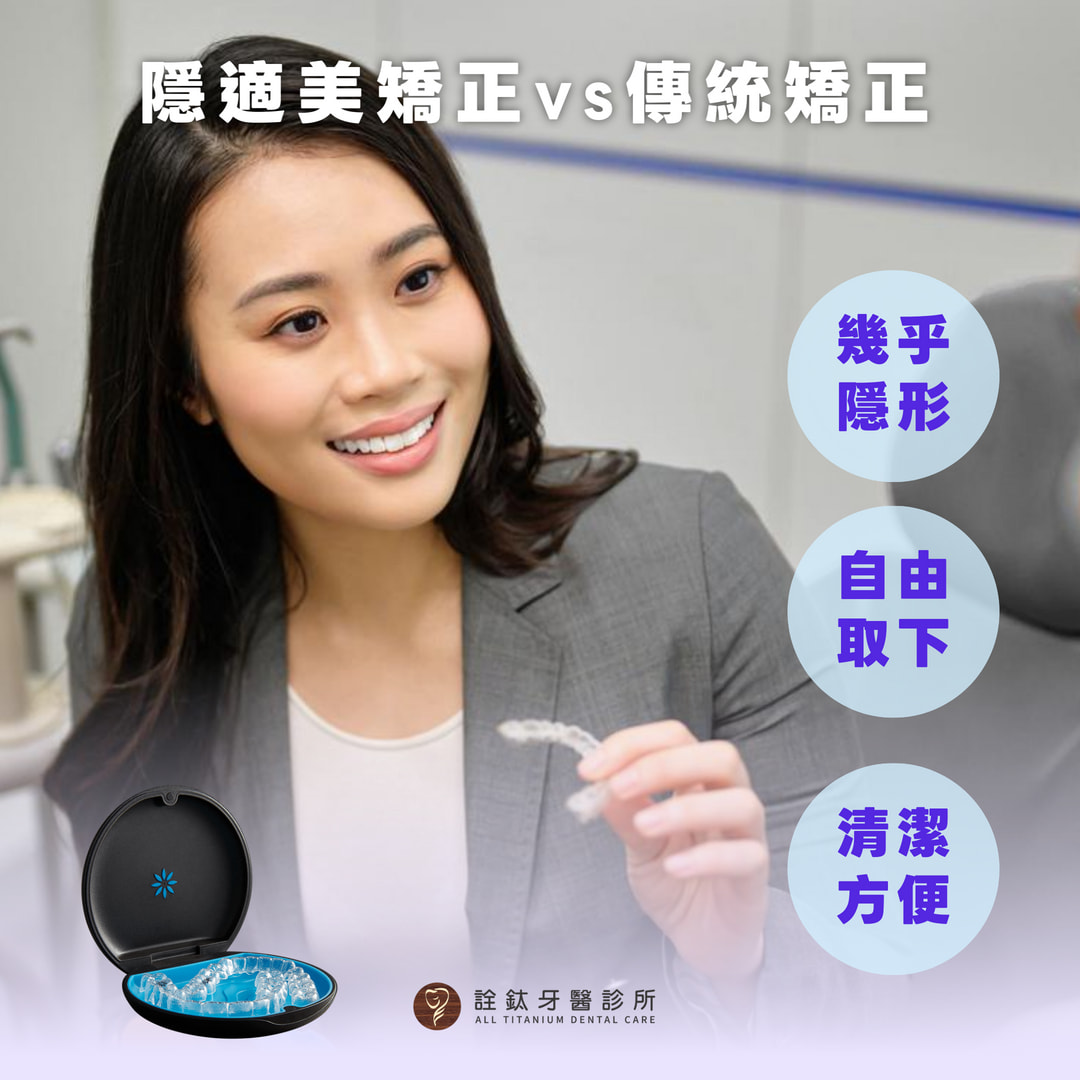 隱適美 vs 傳統牙套