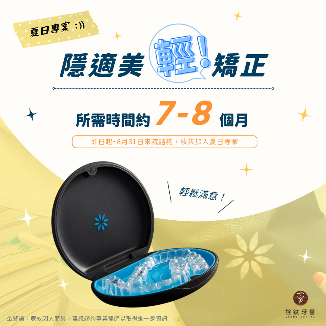 ? 詮鈦牙醫夏日隱適美輕矯正專案火熱登場！?