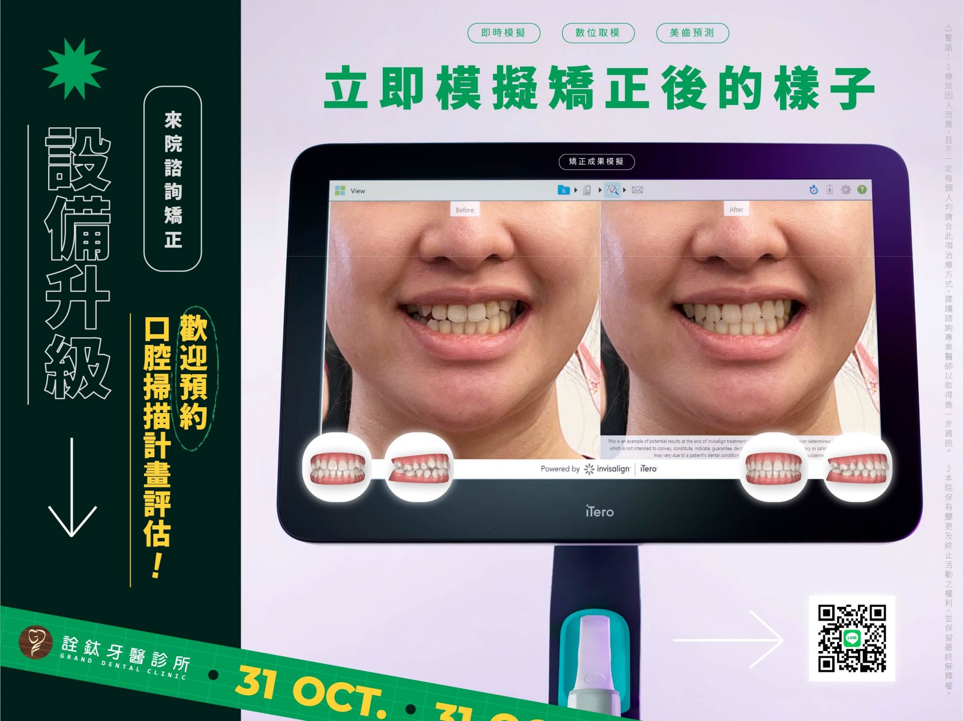 詮鈦矯正設備再升級?【iTero口腔掃描機】