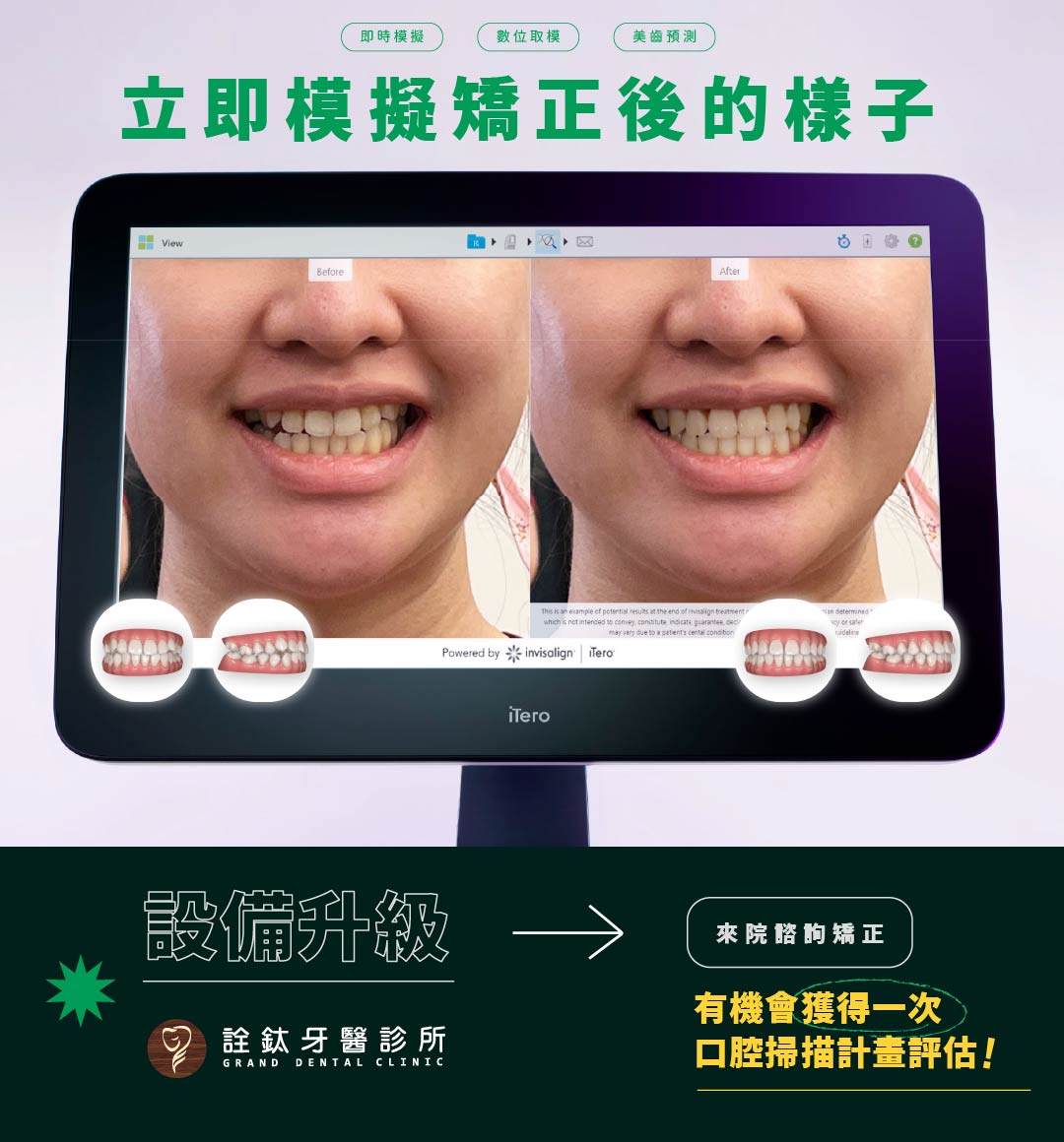 💡 全新升級的 iTero Lumina 口掃儀正式登場！