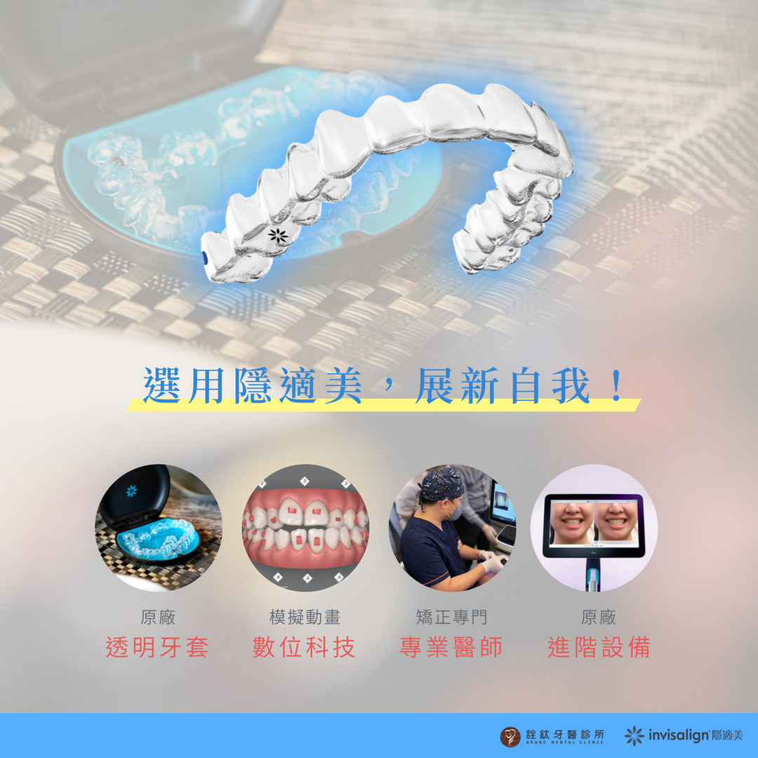 選用隱適美，展現自我～