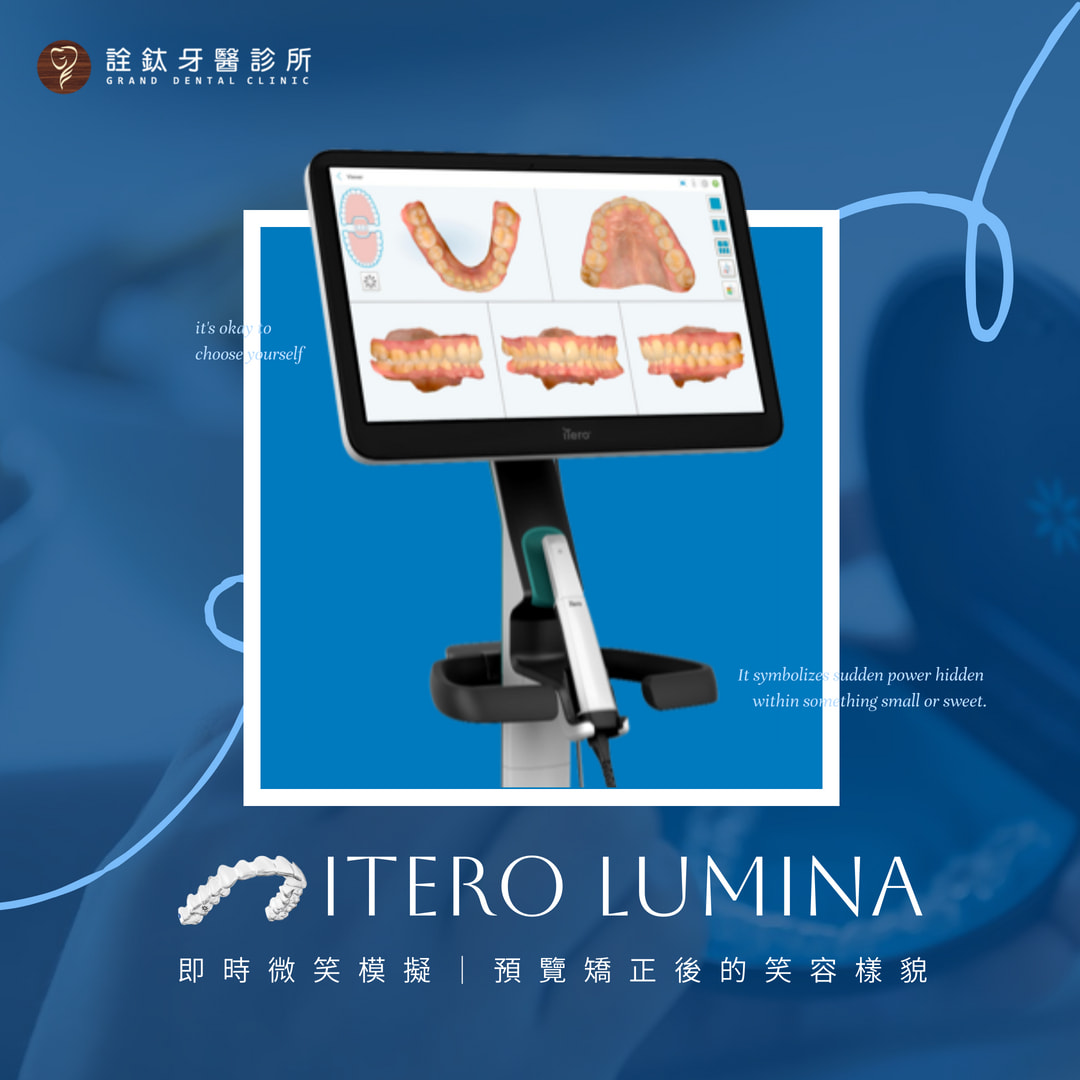 🔔 全新iTero Lumina口掃機來襲！ 🔔