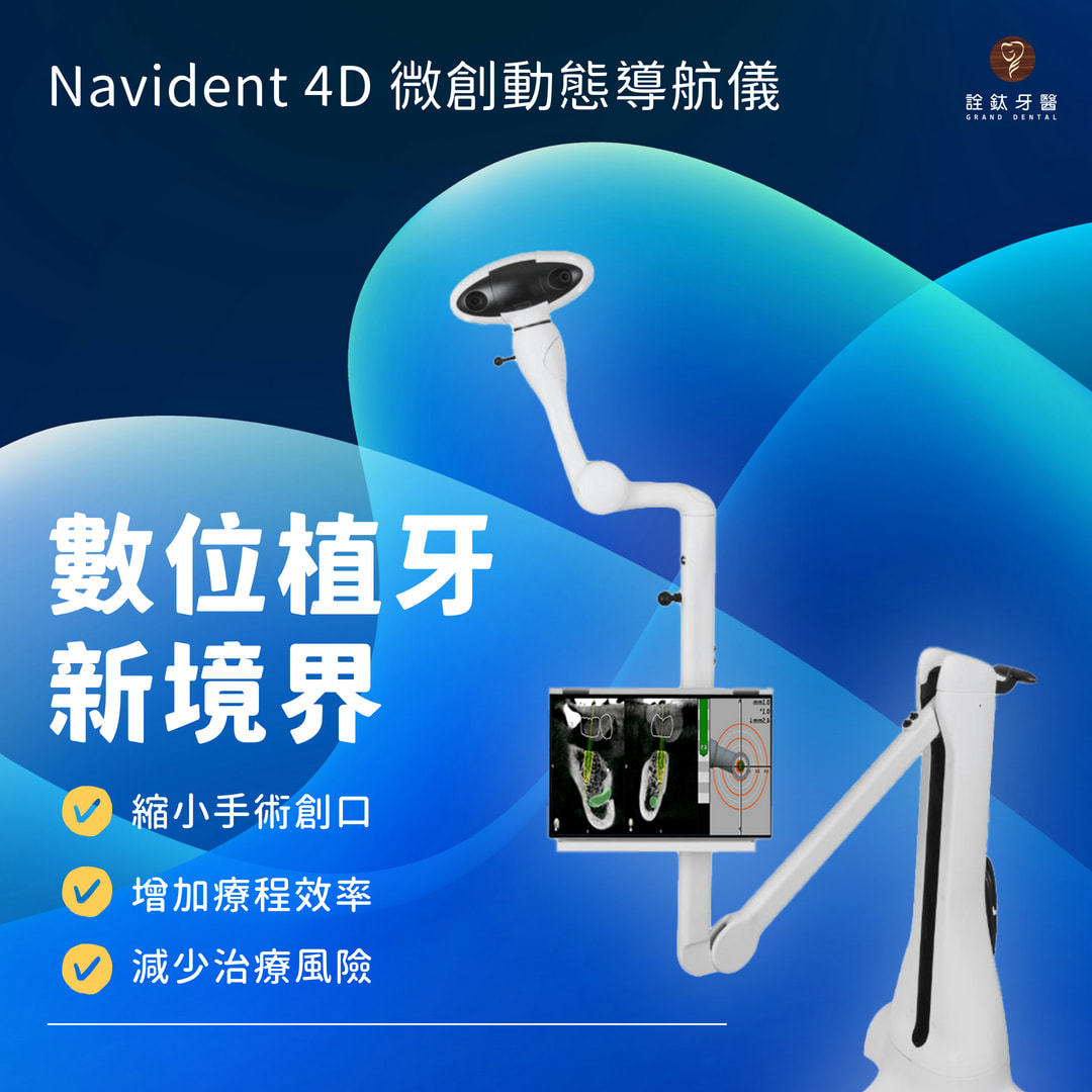 植牙，不只要求穩，更要精確🆙