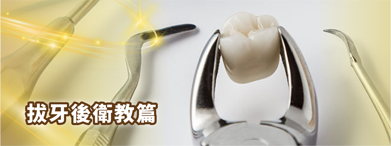 【拔牙後衛教篇】 【拔牙後衛教篇】