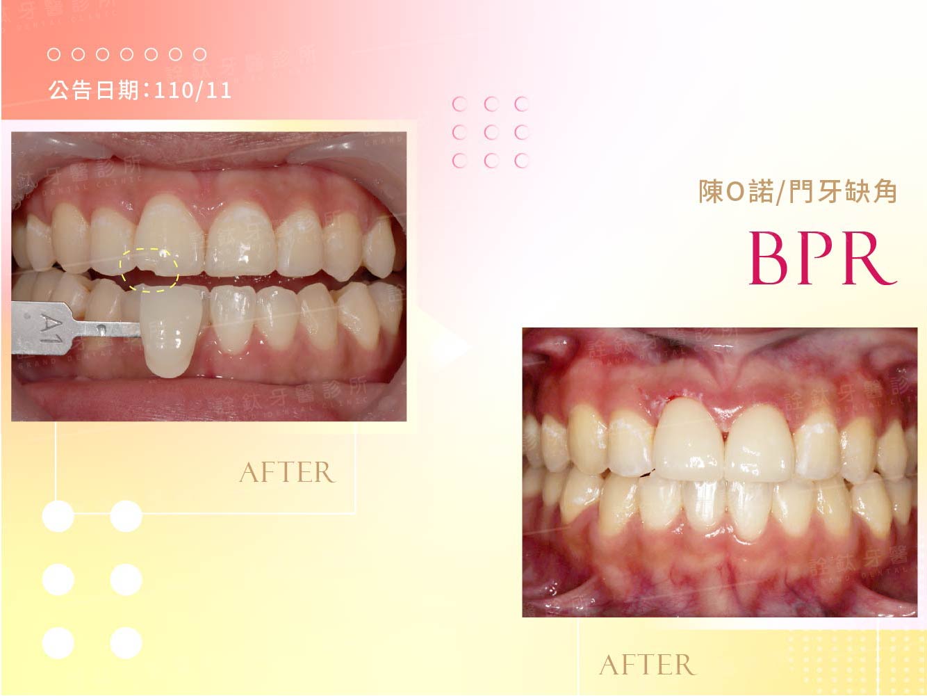 一日美齒 一日美齒