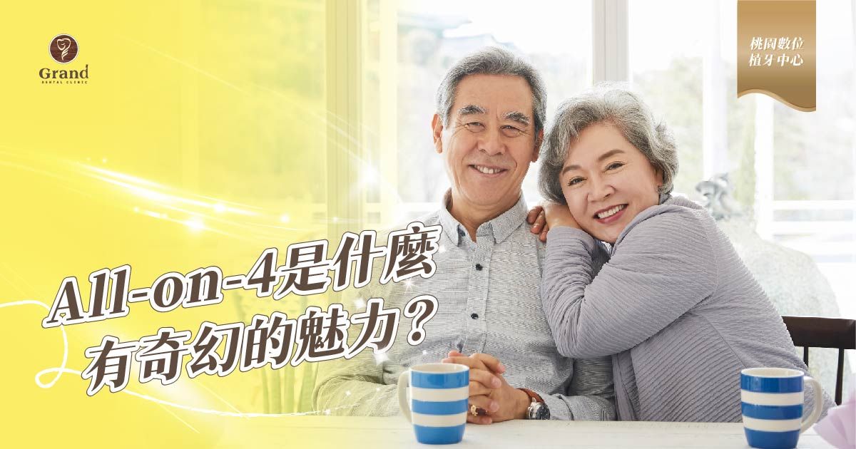 All-on-4是什麼，有什麼奇幻的魅力？
