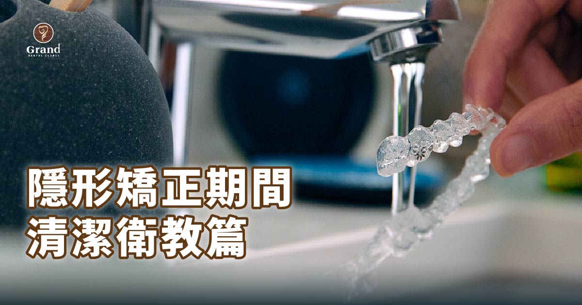 【隱形矯正期間愛注意+清潔衛教篇】